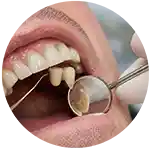 tratamiento protesis dental